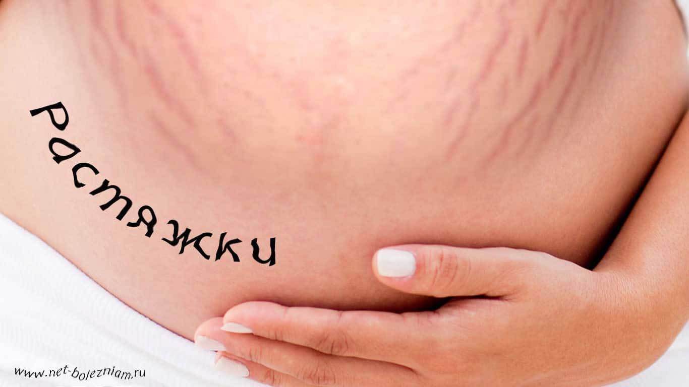 вены на груди это признак беременности фото 44